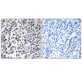 Immunohistochemistry - Anti-CD302 Antibody (C12150) - Antibodies.com