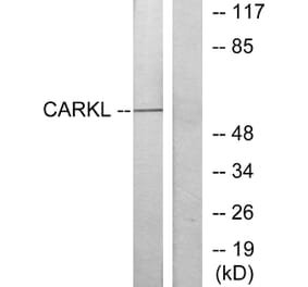Western Blot - Anti-CARKL Antibody (C11846) - Antibodies.com