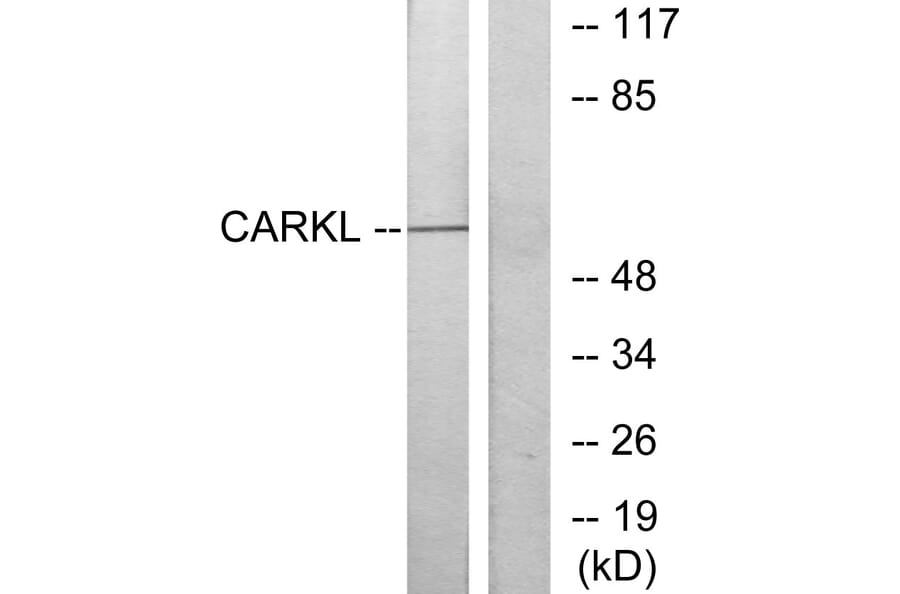 Western Blot - Anti-CARKL Antibody (C11846) - Antibodies.com