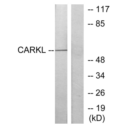 Western Blot - Anti-CARKL Antibody (C11846) - Antibodies.com