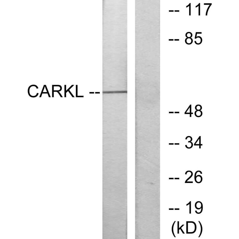 Western Blot - Anti-CARKL Antibody (C11846) - Antibodies.com
