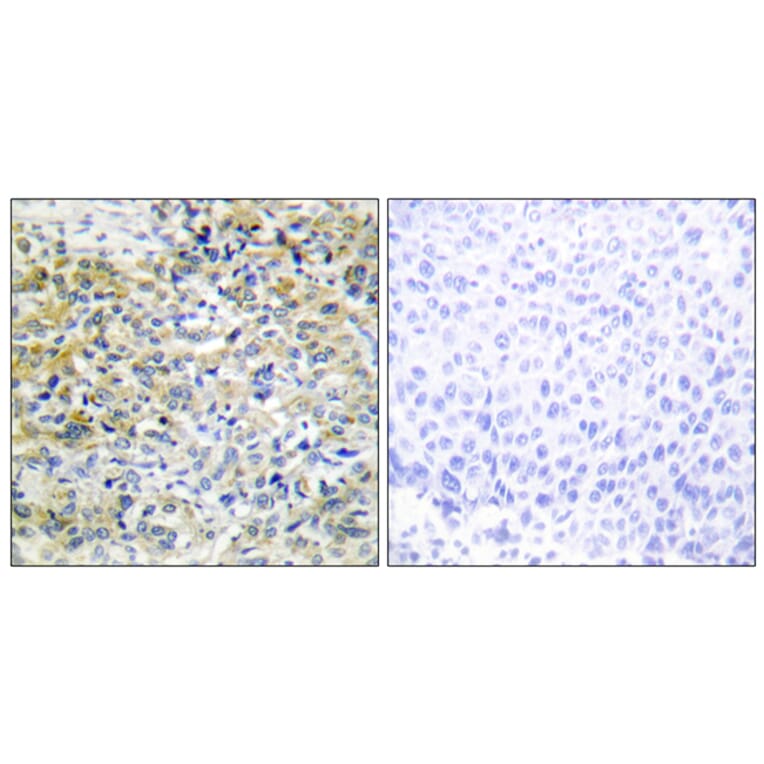 Immunohistochemistry - Anti-CARKL Antibody (C11846) - Antibodies.com