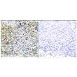 Immunohistochemistry - Anti-CARKL Antibody (C11846) - Antibodies.com