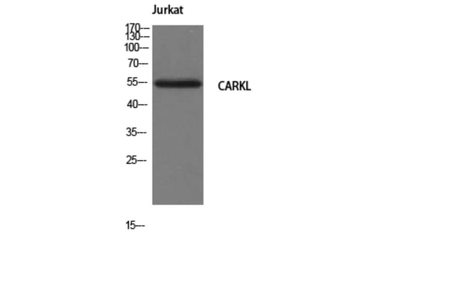 Western Blot - Anti-CARKL Antibody (C11846) - Antibodies.com