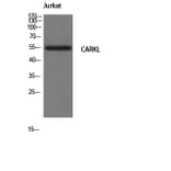 Western Blot - Anti-CARKL Antibody (C11846) - Antibodies.com