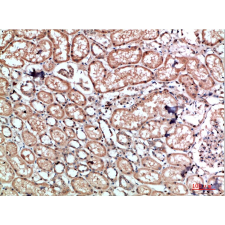 Immunohistochemistry - Anti-CALD1 Antibody (C30874) - Antibodies.com