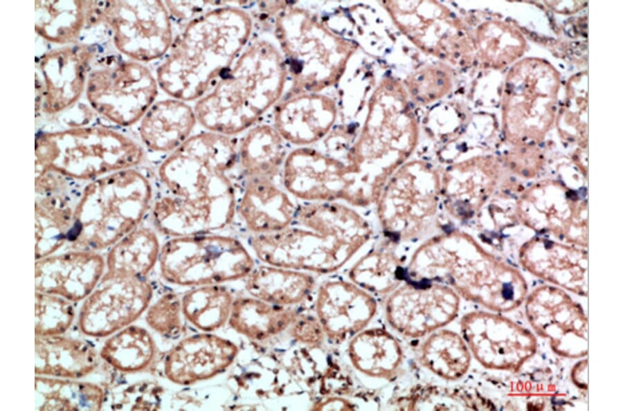 Immunohistochemistry - Anti-CALD1 Antibody (C30874) - Antibodies.com