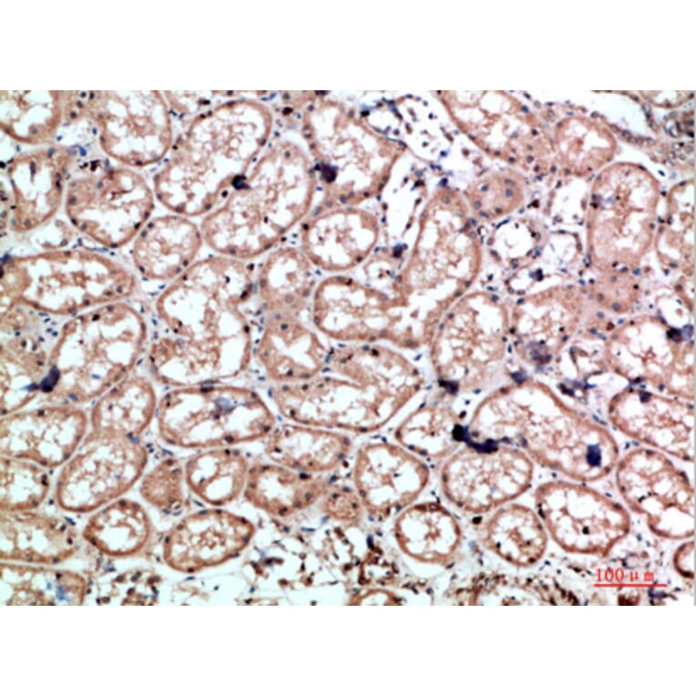 Immunohistochemistry - Anti-CALD1 Antibody (C30874) - Antibodies.com