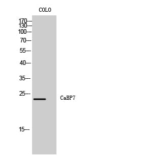 Western blot analysis of COLO cells using Anti-CABP7 Antibody.