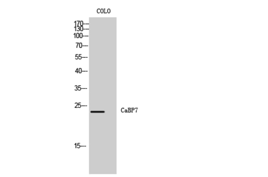 Western Blot - Anti-CABP7 Antibody (C14850) - Antibodies.com