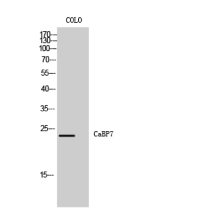 Western Blot - Anti-CABP7 Antibody (C14850) - Antibodies.com