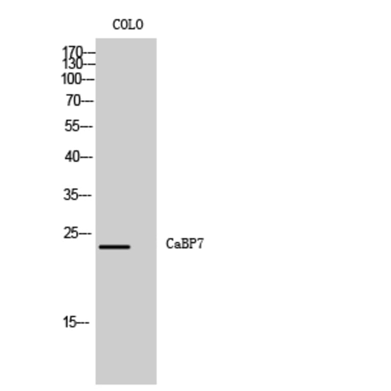 Western Blot - Anti-CABP7 Antibody (C14850) - Antibodies.com