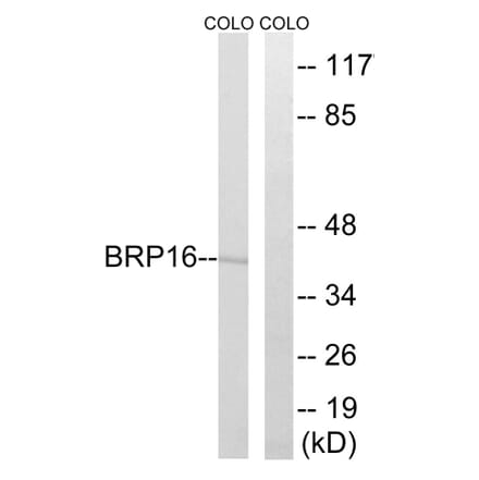 Western Blot - Anti-BRP16 Antibody (C14779) - Antibodies.com