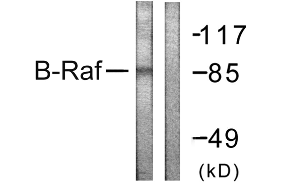 Western Blot - Anti-B-RAF Antibody (B0781) - Antibodies.com
