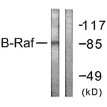 Western Blot - Anti-B-RAF Antibody (B0781) - Antibodies.com