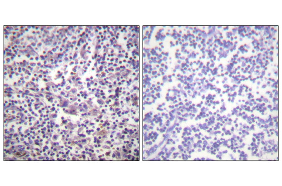 Immunohistochemistry - Anti-B-RAF Antibody (B0781) - Antibodies.com