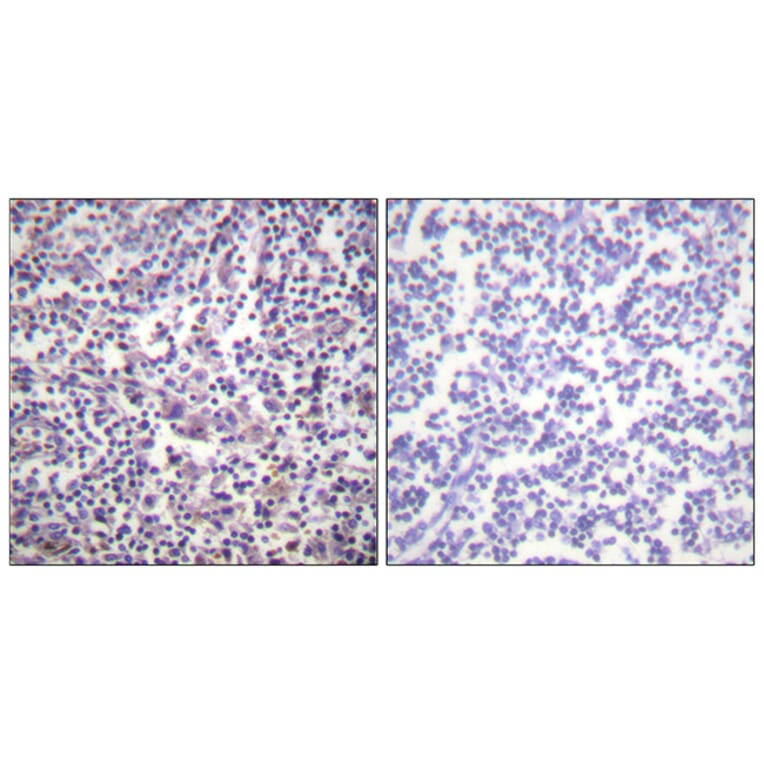 Immunohistochemistry - Anti-B-RAF Antibody (B0781) - Antibodies.com