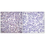 Immunohistochemistry - Anti-B-RAF Antibody (B0781) - Antibodies.com