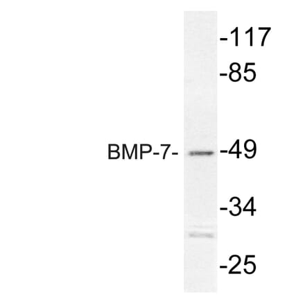 Western Blot - Anti-BMP-7 Antibody (R12-2039) - Antibodies.com
