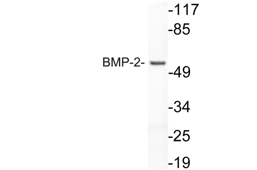 Western Blot - Anti-BMP-2 Antibody (R12-2034) - Antibodies.com