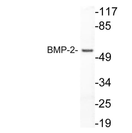 Western Blot - Anti-BMP-2 Antibody (R12-2034) - Antibodies.com