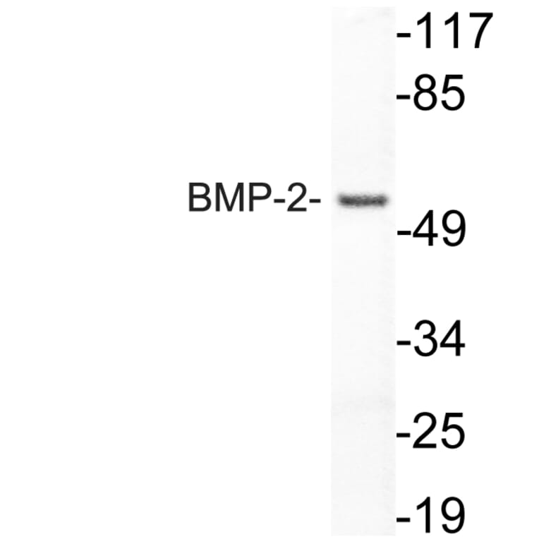 Western Blot - Anti-BMP-2 Antibody (R12-2034) - Antibodies.com