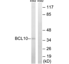 Western Blot - Anti-BCL10 Antibody (C13030) - Antibodies.com