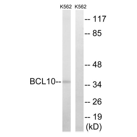 Western Blot - Anti-BCL10 Antibody (C13030) - Antibodies.com