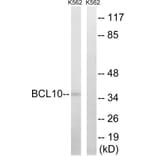 Western Blot - Anti-BCL10 Antibody (C13030) - Antibodies.com