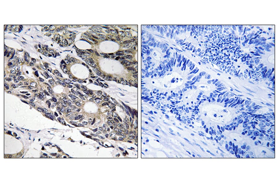 Immunohistochemistry - Anti-BCL10 Antibody (C13030) - Antibodies.com