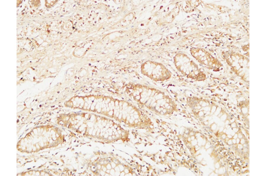 Immunohistochemistry - Anti-BCL10 Antibody (C13030) - Antibodies.com
