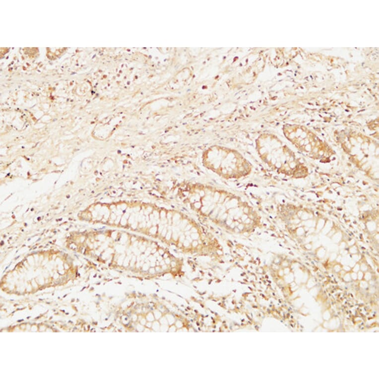 Immunohistochemistry - Anti-BCL10 Antibody (C13030) - Antibodies.com