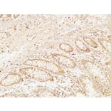 Immunohistochemistry - Anti-BCL10 Antibody (C13030) - Antibodies.com