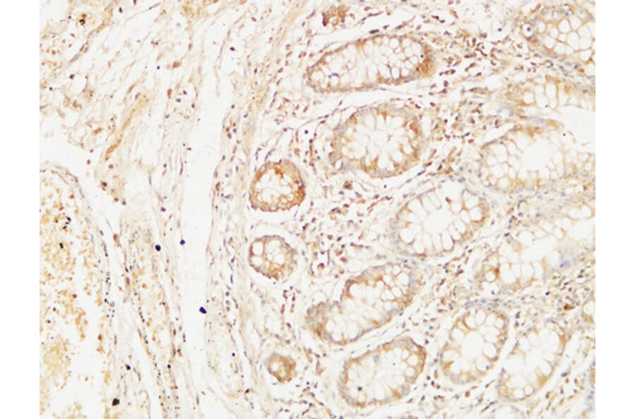 Immunohistochemistry - Anti-BCL10 Antibody (C13030) - Antibodies.com