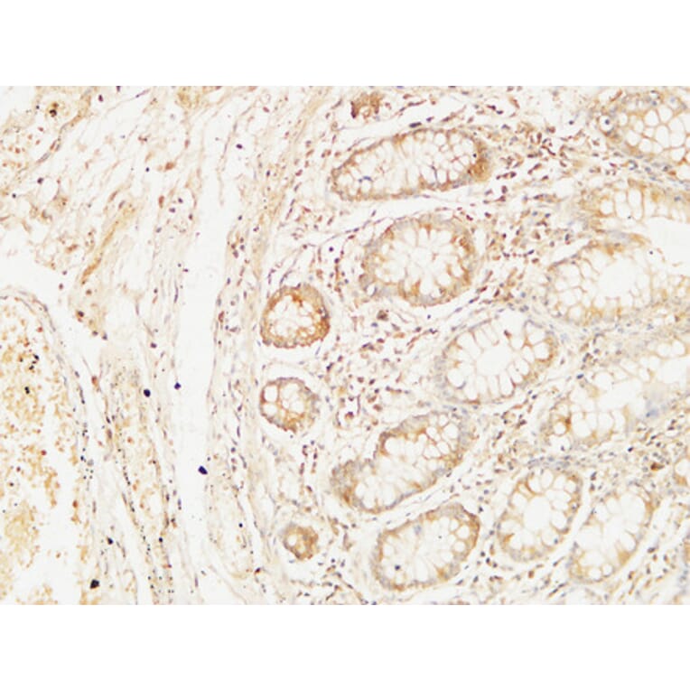 Immunohistochemistry - Anti-BCL10 Antibody (C13030) - Antibodies.com