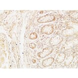 Immunohistochemistry - Anti-BCL10 Antibody (C13030) - Antibodies.com