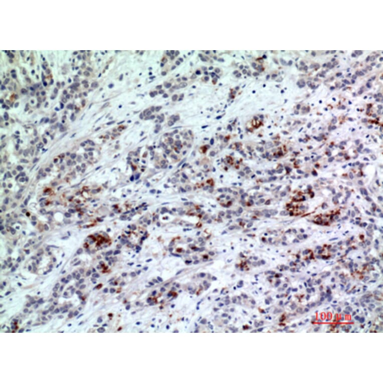Immunohistochemistry - Anti-BATF3 Antibody (C30994) - Antibodies.com