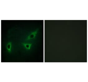 Immunofluorescence - Anti-ATP7B Antibody (C10562) - Antibodies.com