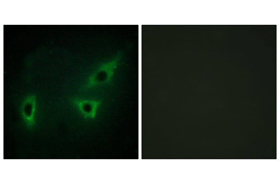 Immunofluorescence - Anti-ATP7B Antibody (C10562) - Antibodies.com