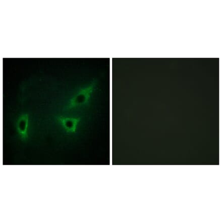 Immunofluorescence - Anti-ATP7B Antibody (C10562) - Antibodies.com