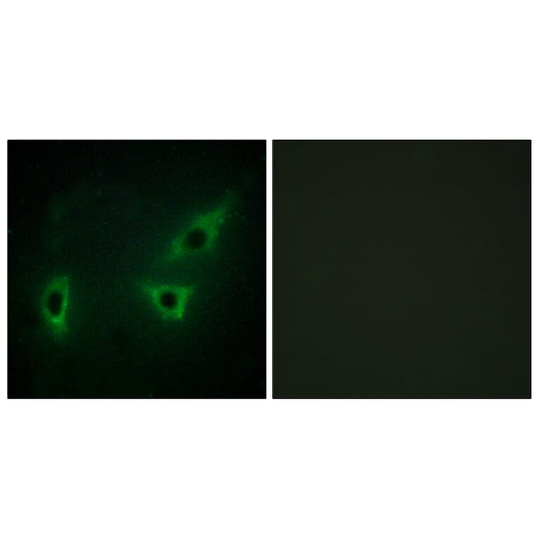 Immunofluorescence - Anti-ATP7B Antibody (C10562) - Antibodies.com