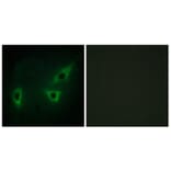 Immunofluorescence - Anti-ATP7B Antibody (C10562) - Antibodies.com
