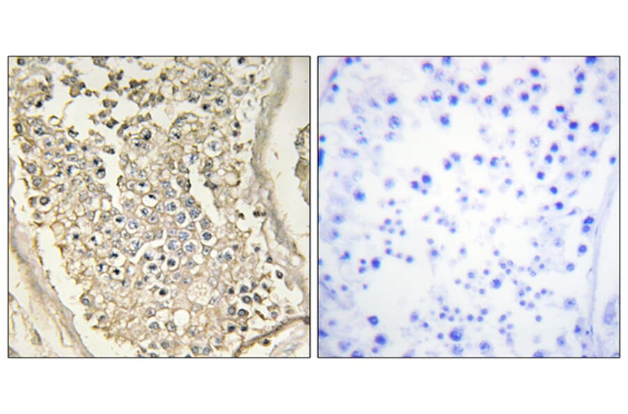 Immunohistochemistry - Anti-ATP7B Antibody (C10562) - Antibodies.com
