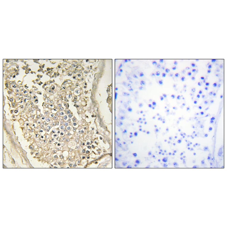 Immunohistochemistry - Anti-ATP7B Antibody (C10562) - Antibodies.com