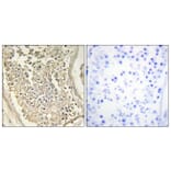 Immunohistochemistry - Anti-ATP7B Antibody (C10562) - Antibodies.com