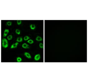 Immunofluorescence - Anti-ATP5D Antibody (C14592) - Antibodies.com