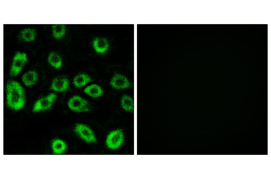 Immunofluorescence - Anti-ATP5D Antibody (C14592) - Antibodies.com