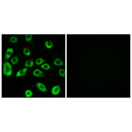 Immunofluorescence - Anti-ATP5D Antibody (C14592) - Antibodies.com