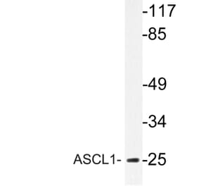 Western Blot - Anti-ASCL1 Antibody (R12-2031) - Antibodies.com