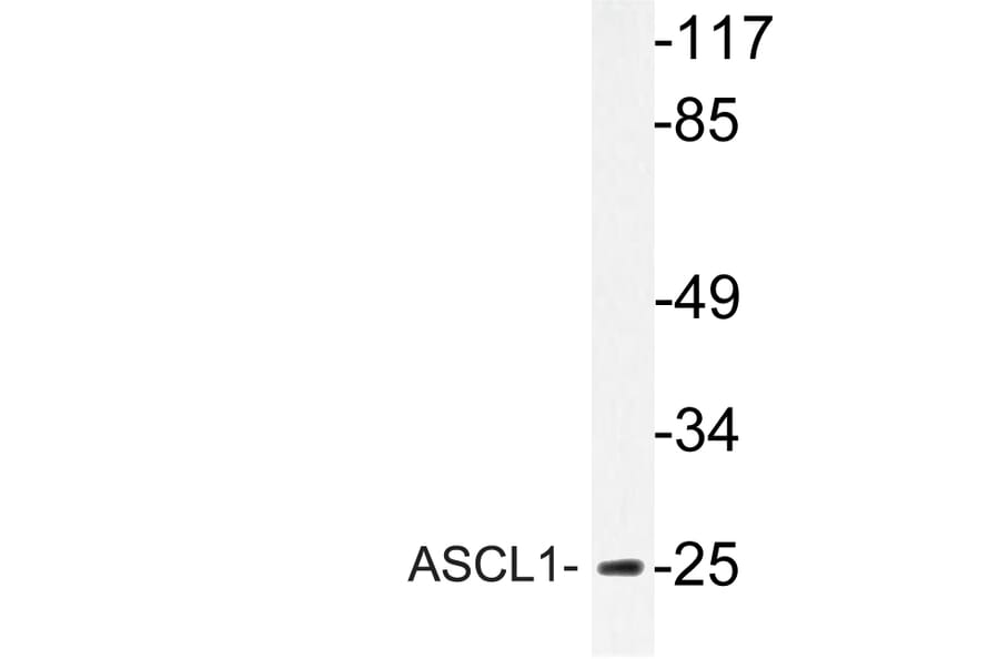 Western Blot - Anti-ASCL1 Antibody (R12-2031) - Antibodies.com